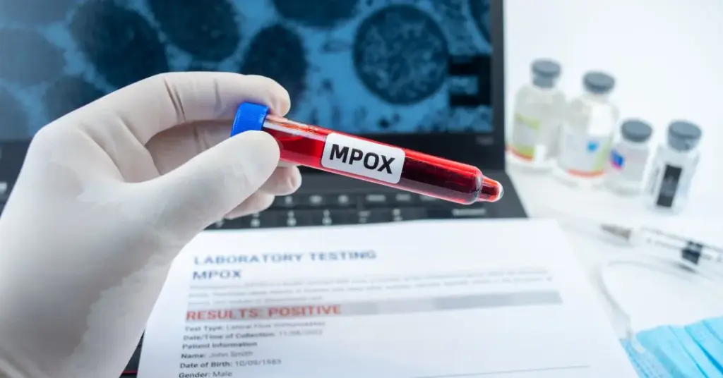 doenca mpox casos — BR news