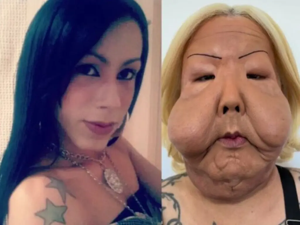juju do pix antes e depois