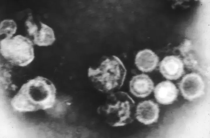 virus epstein barr — BR news
